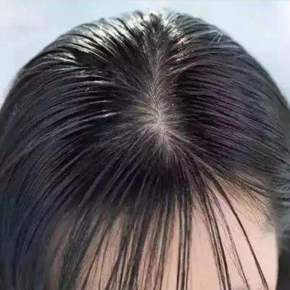嘆頭部SPA！拒做人間油物解鎖防禿養(yǎng)發(fā)小妙招