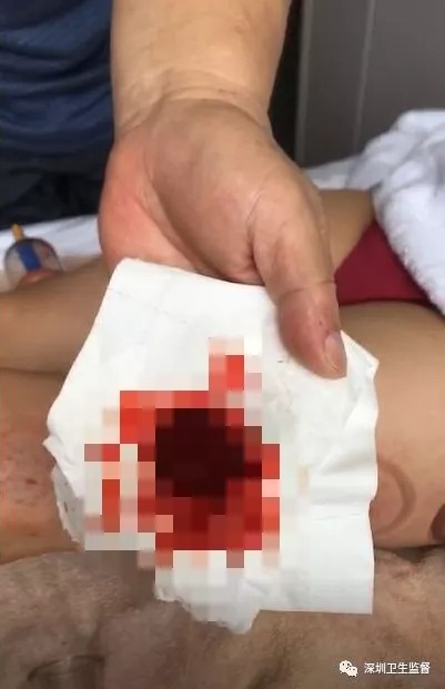 收費10萬！酒店內給女子做按摩羅湖男子最后倒賠8萬