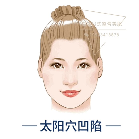 太原現(xiàn)！日式整骨小臉術(shù)！大V明星爆紅全靠它~