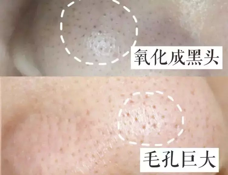 免費(fèi)美膚SPA！韓國(guó)小姐姐都在做的高端護(hù)理就藏在高新